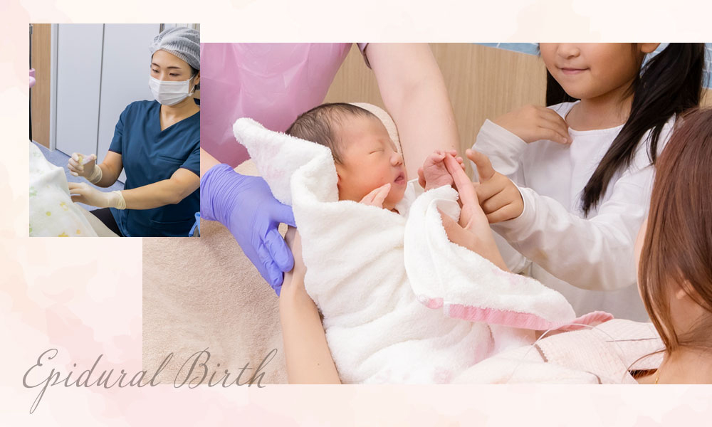 計画無痛分娩の対象と流れ